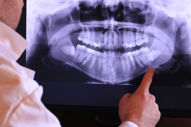 Best Emergency Tooth Extraction in Martin, TN